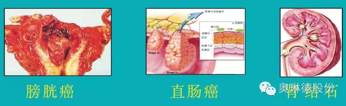 国外有哪些情趣用品中国禁用_为什么国外禁用银离子_国外禁止银离子