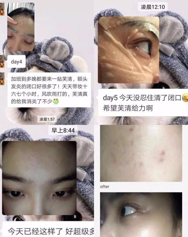 美白针骗局_美白针价格表_美白针团购